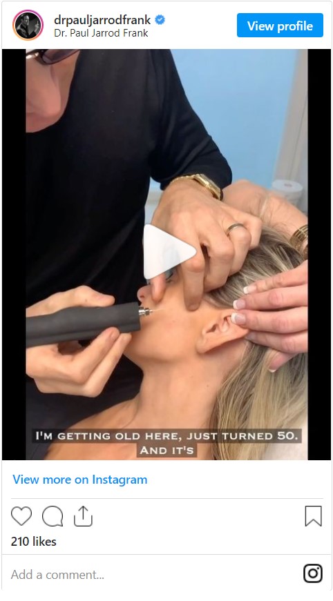 Subnovii Plasma Resurfacing treatment video by Dr. Paul Jarrod Frank of PFRANKMD in New York City, NY