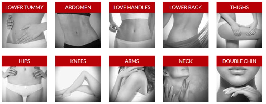 Best areas to target with Liposuction