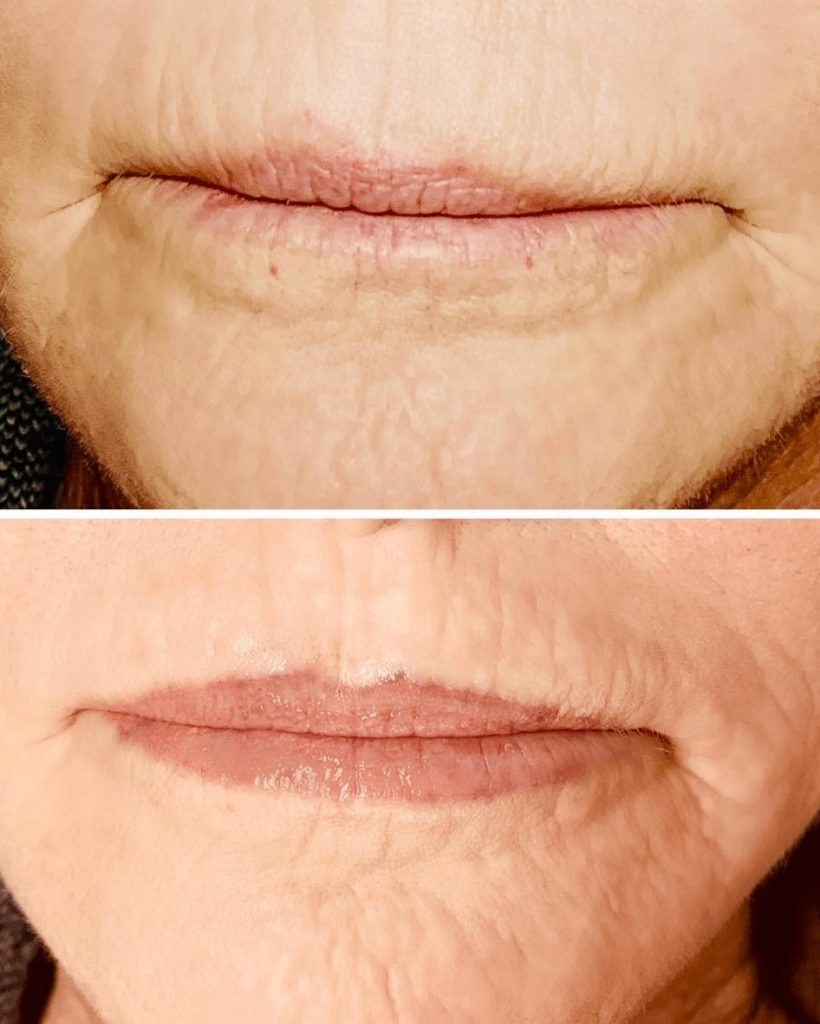 permanent lip makeup