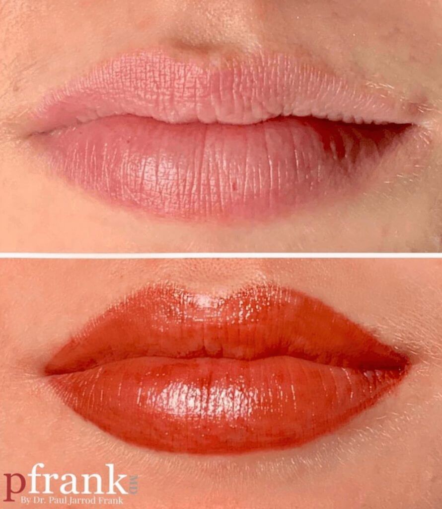 Close-up of a woman's skin after a rejuvenating skincare treatment - April 2022