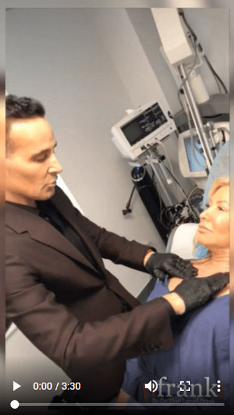 PFRANKMD Threadlifting