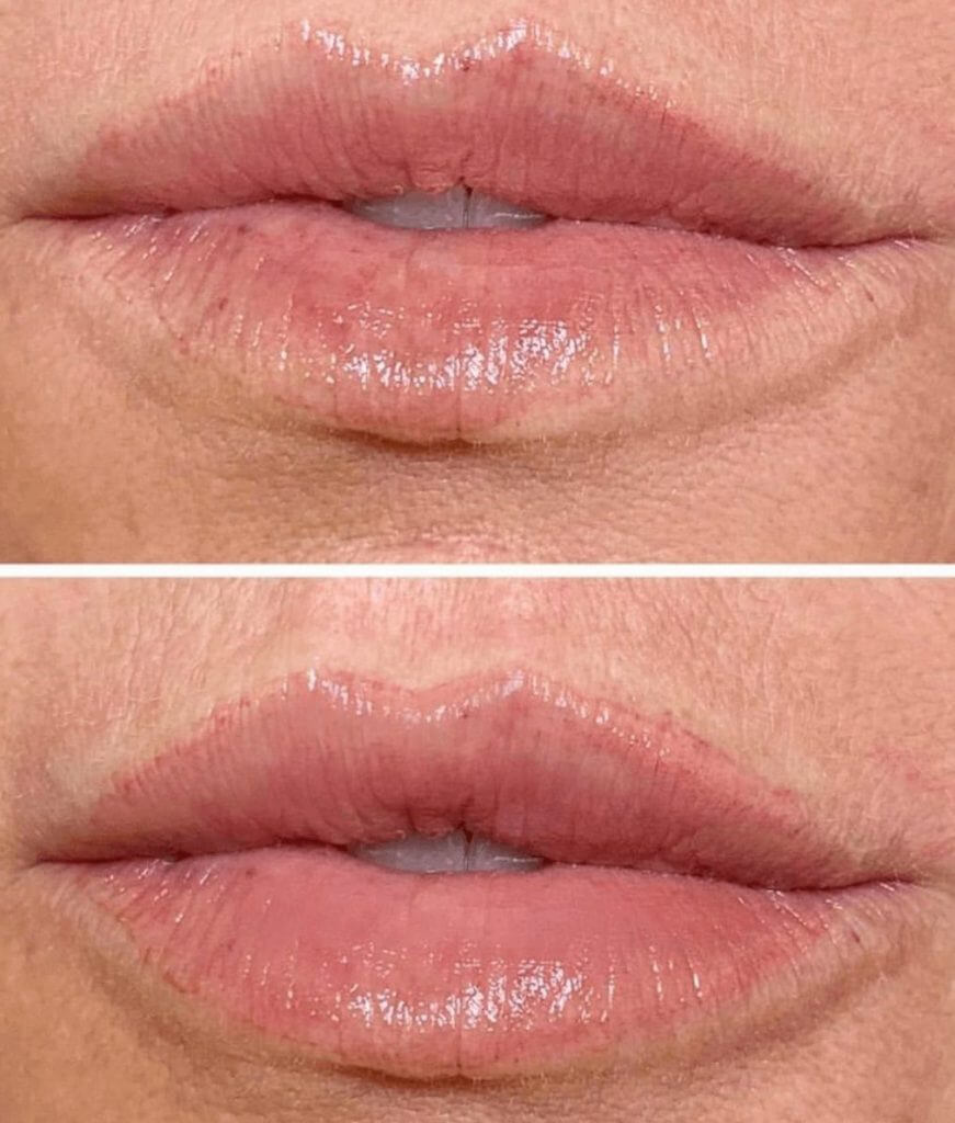 permanent lip makeup