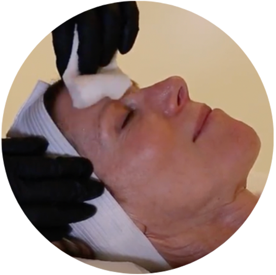 hydrafacial cleanse