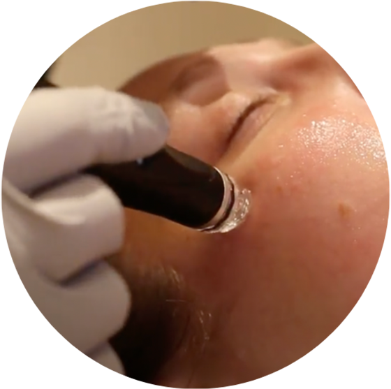 hydrafacial hydrate