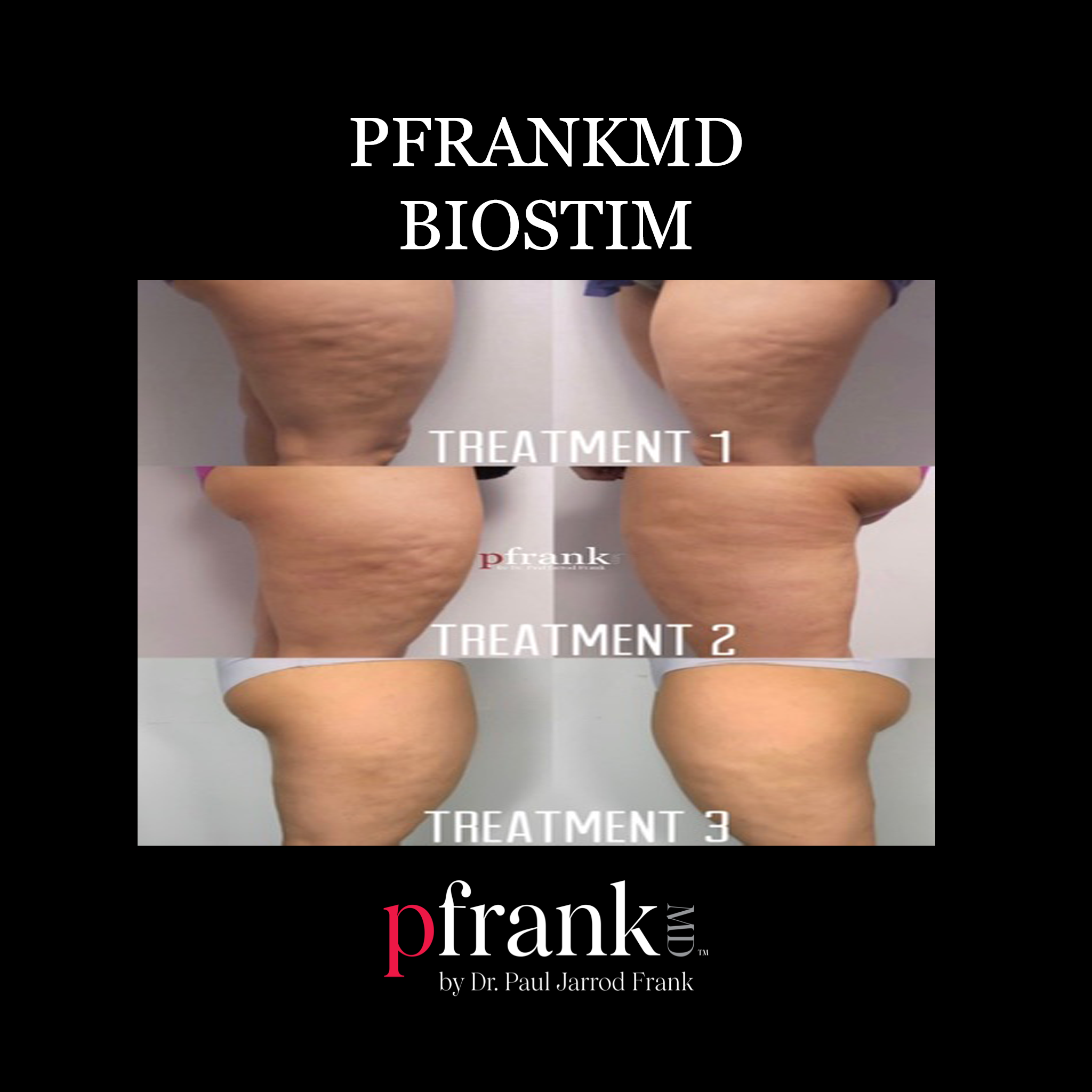 Biostim Treatment before and after